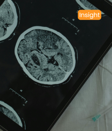 Brain MRI results